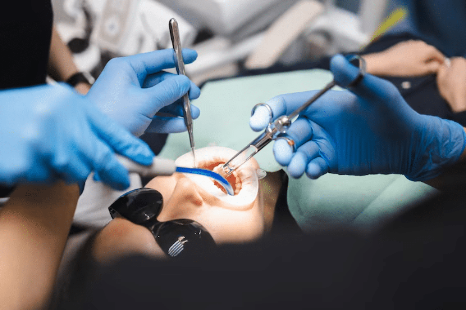 sedation is used for tooth extraction