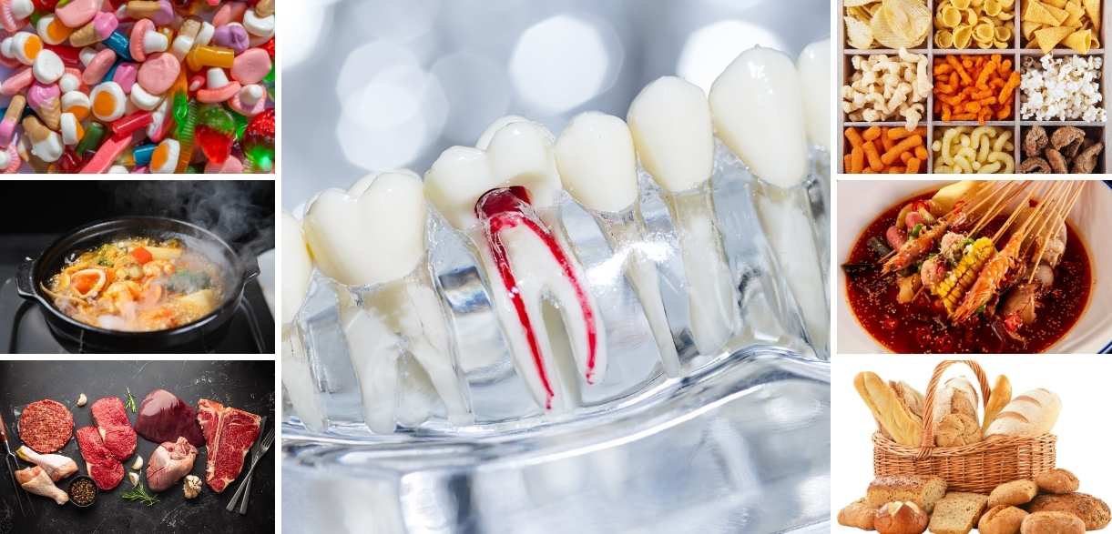 foods to avoid after root canal treatment